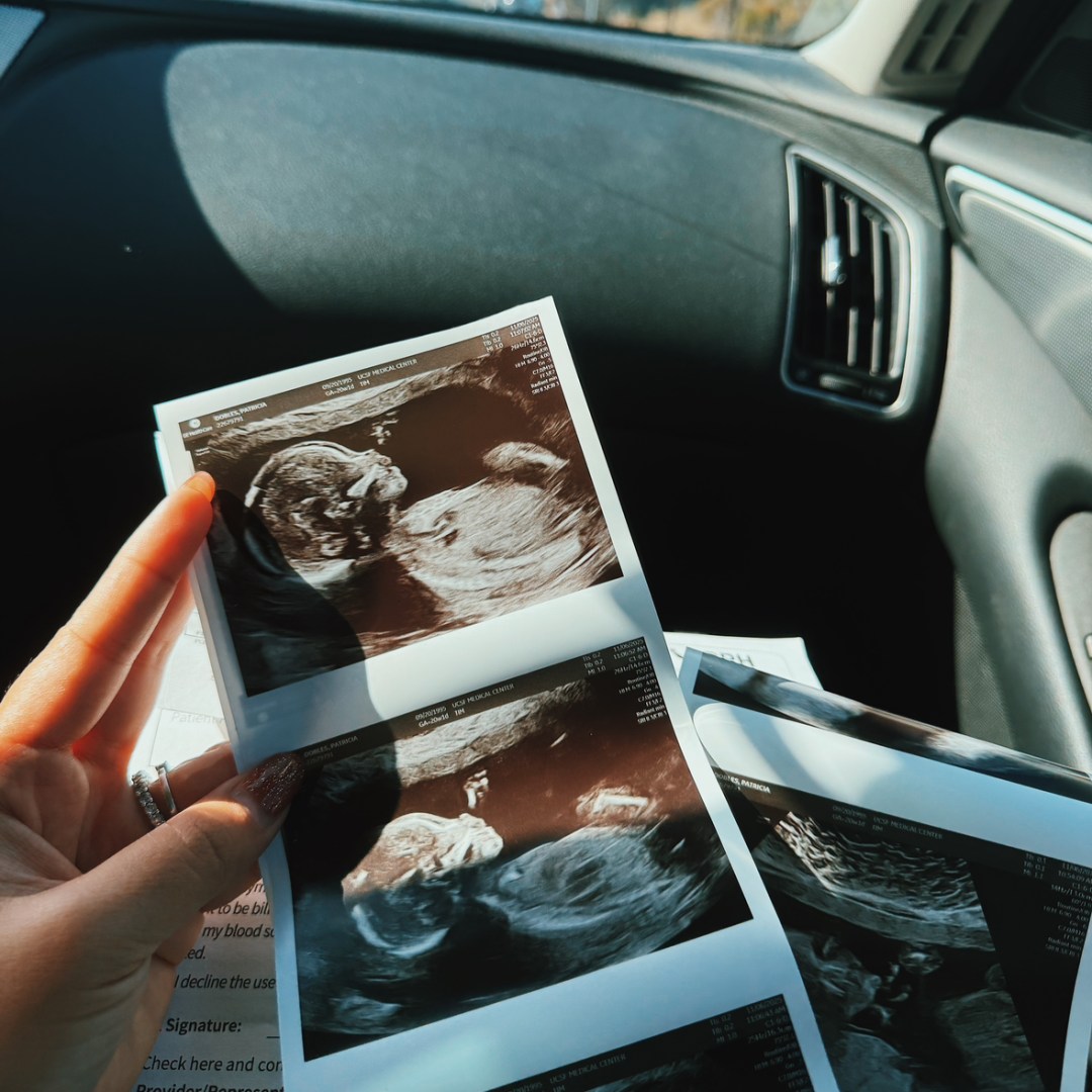 Photo shared by Pae for their Babylist baby registry.