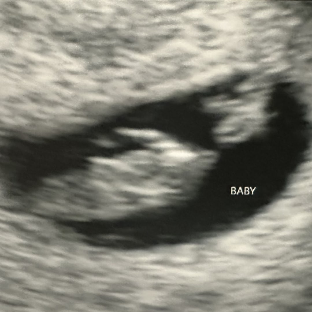 Photo shared by Alyssa for their Babylist baby registry.