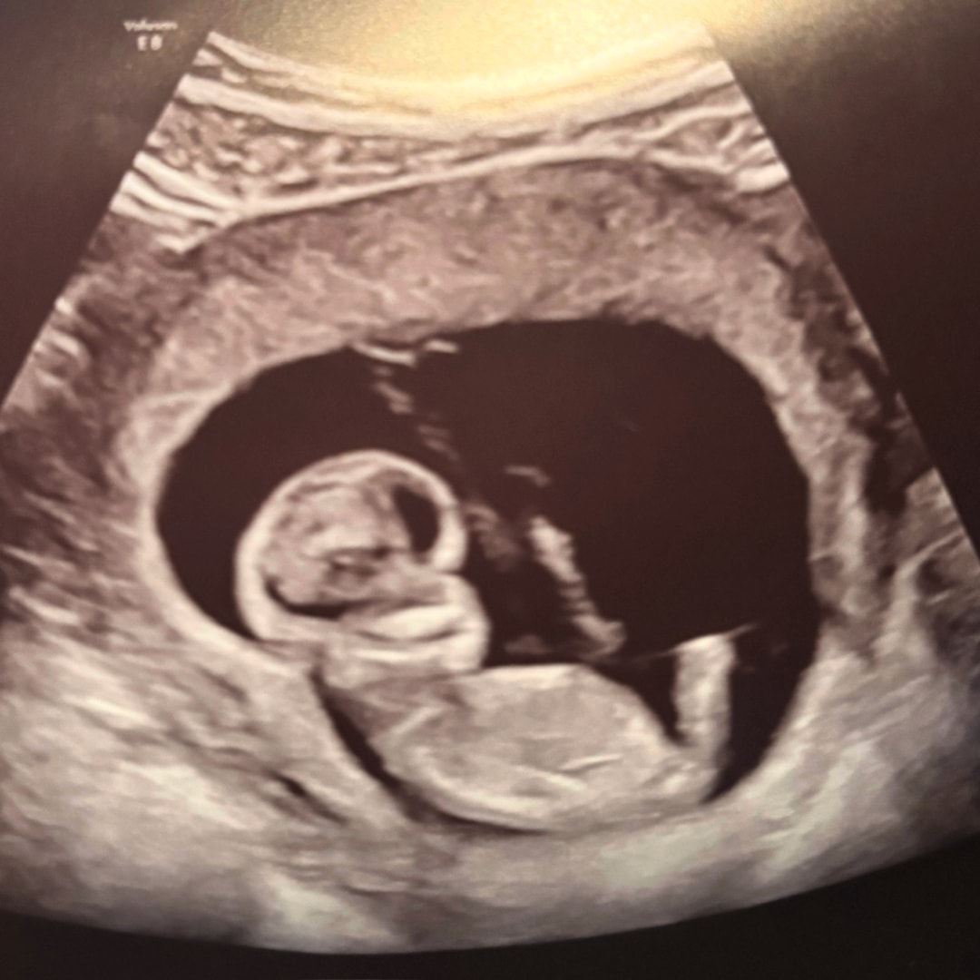 Photo shared by Mia for their Babylist baby registry.