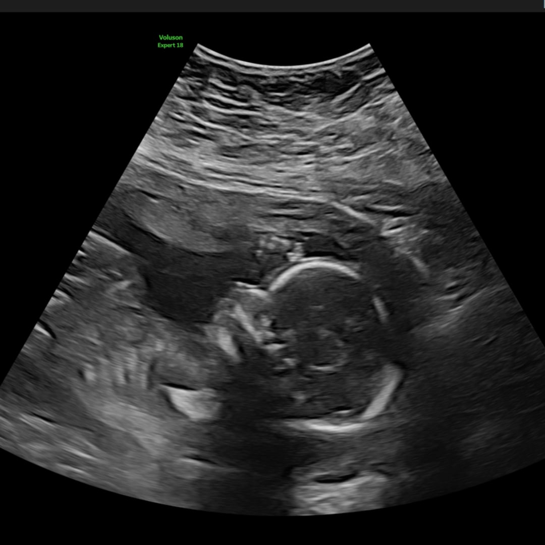 Photo shared by Ally for their Babylist baby registry.