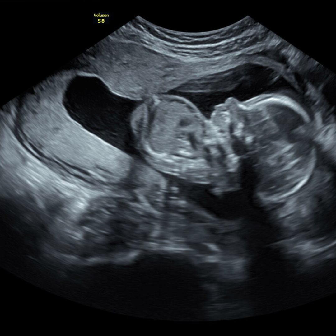 Photo shared by Erin for their Babylist baby registry.