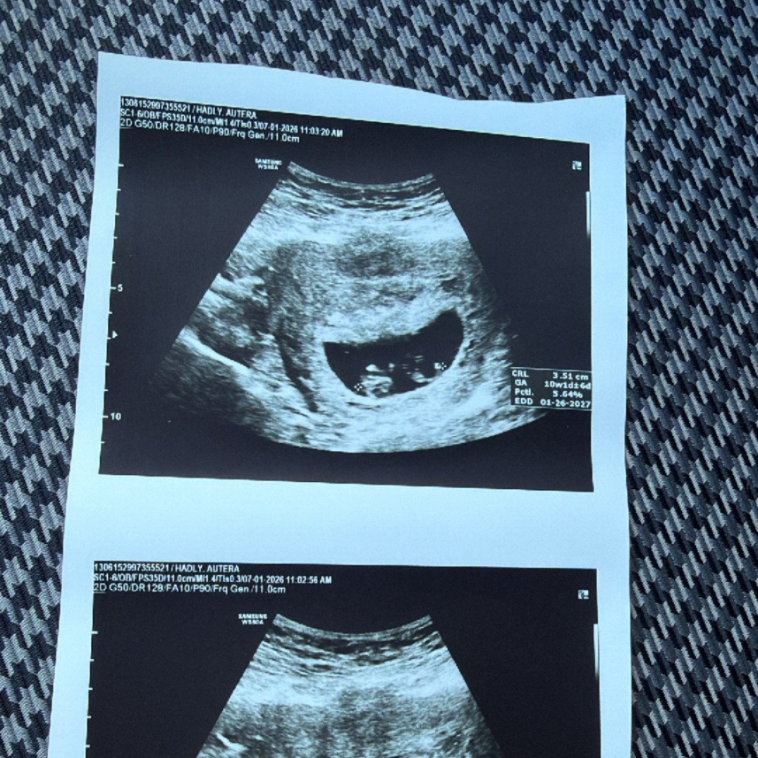 Photo shared by Hadly for their Babylist baby registry.