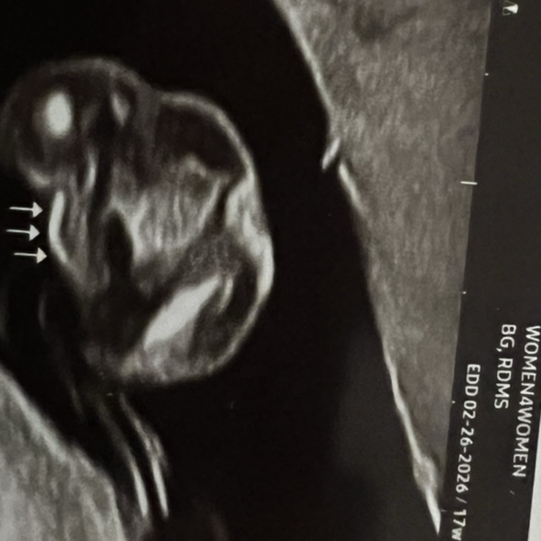 Photo shared by Deaura for their Babylist baby registry.