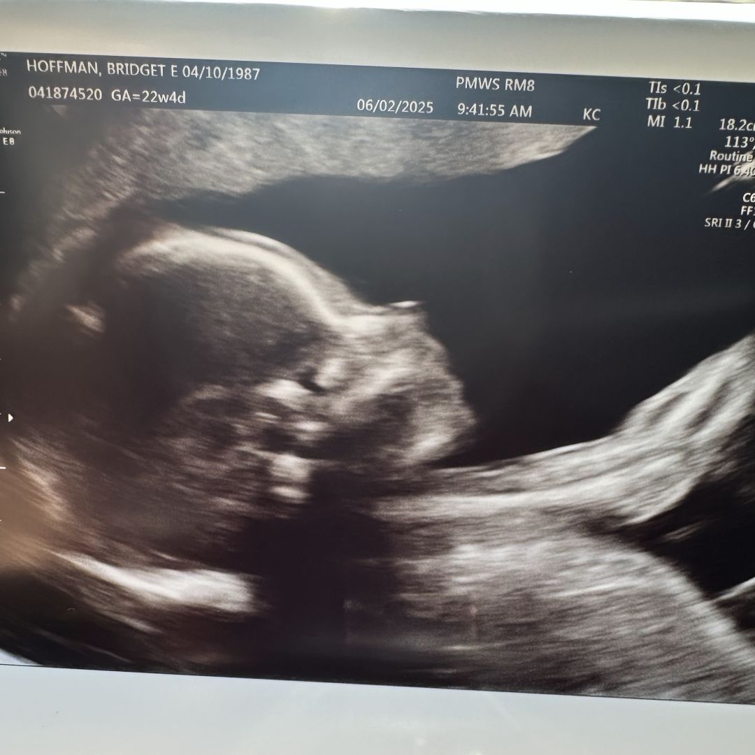 Photo shared by Bridget for their Babylist baby registry.