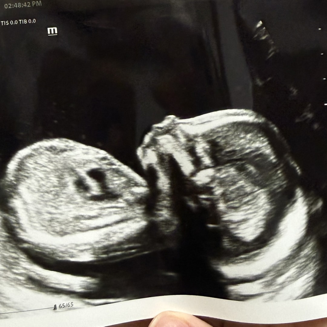Photo shared by Amaris for their Babylist baby registry.