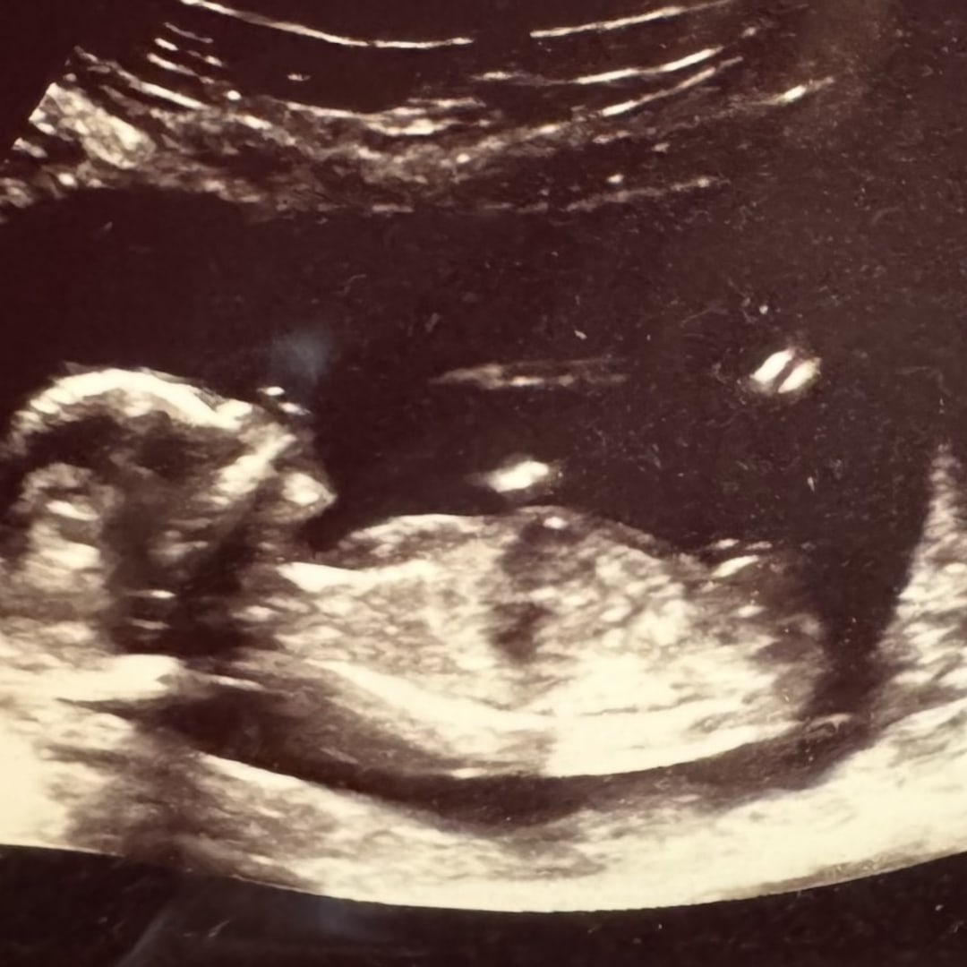 Photo shared by Haley for their Babylist baby registry.