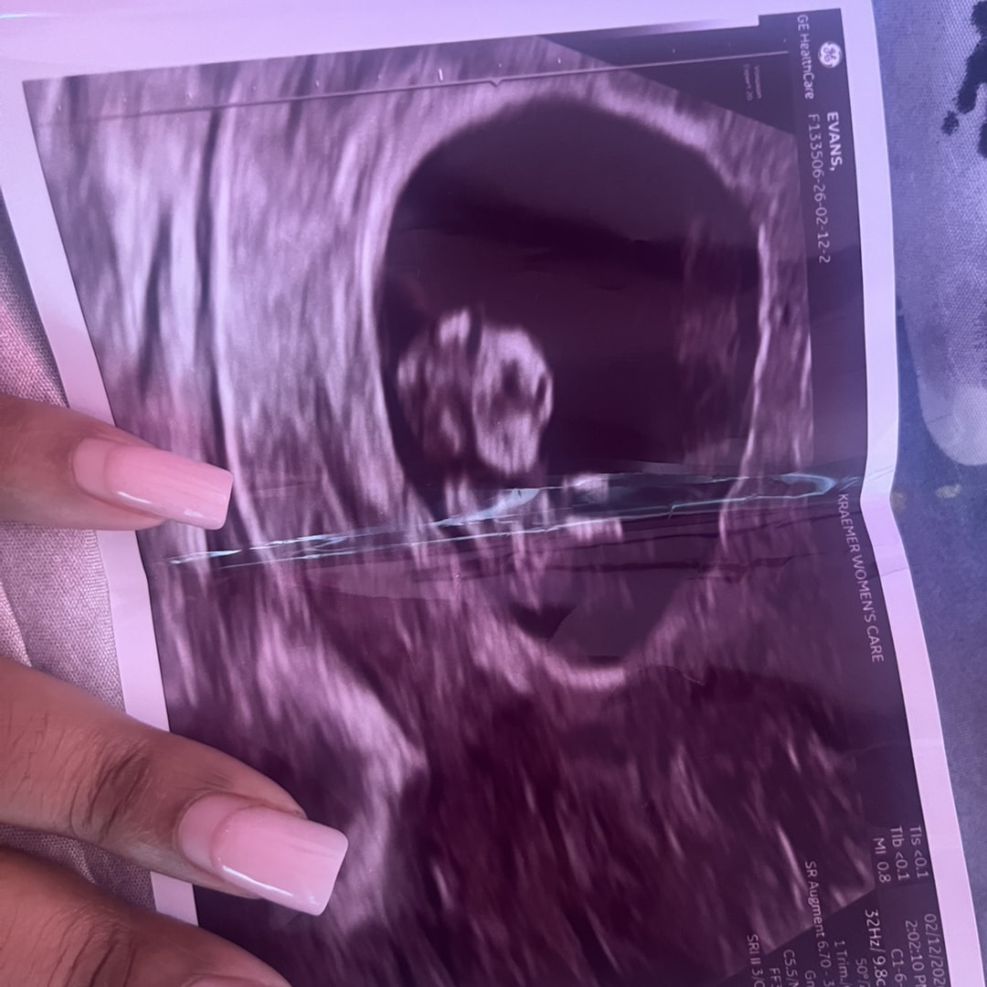 Photo shared by Aleta for their Babylist baby registry.