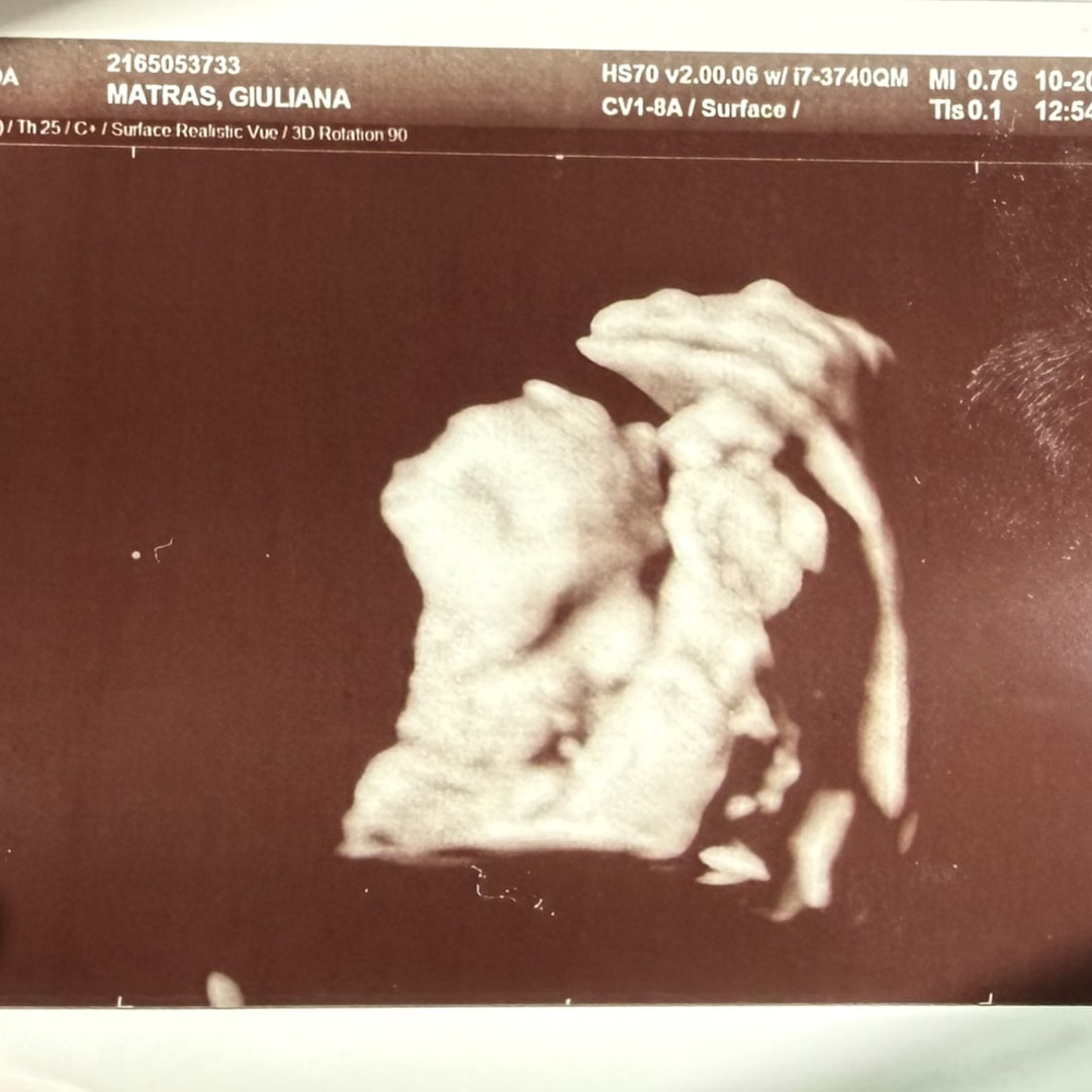 Photo shared by Giuliana for their Babylist baby registry.