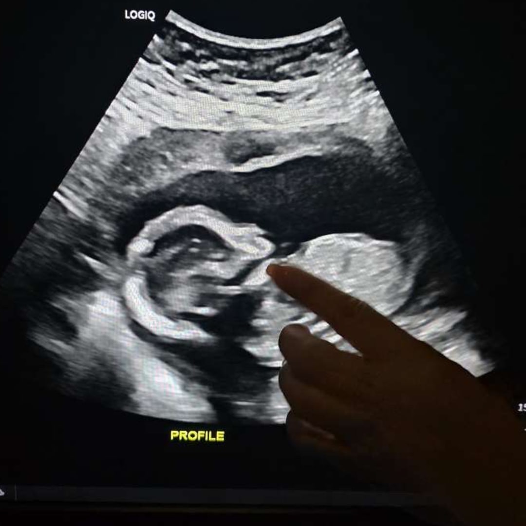 Photo shared by Nancy for their Babylist baby registry.