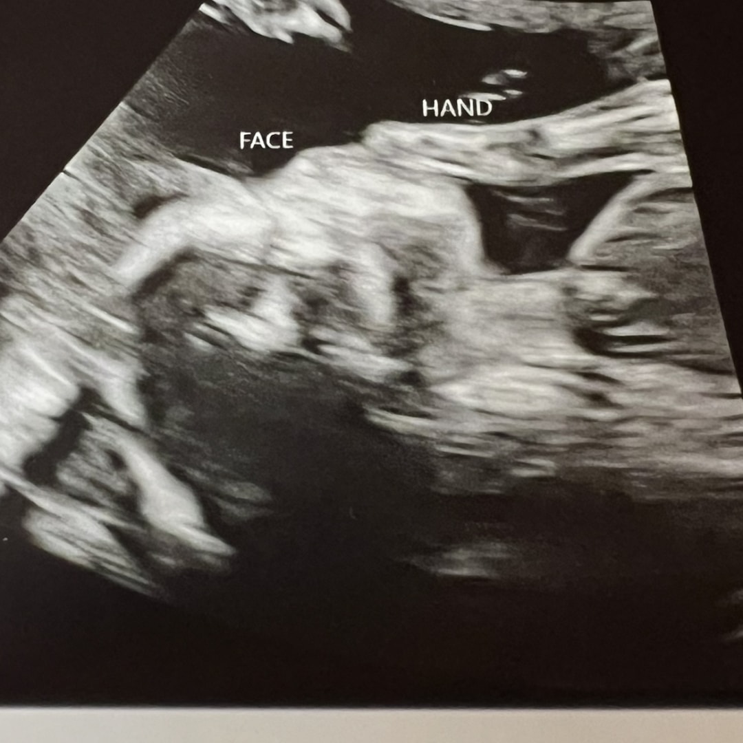 Photo shared by Kaitlynn for their Babylist baby registry.