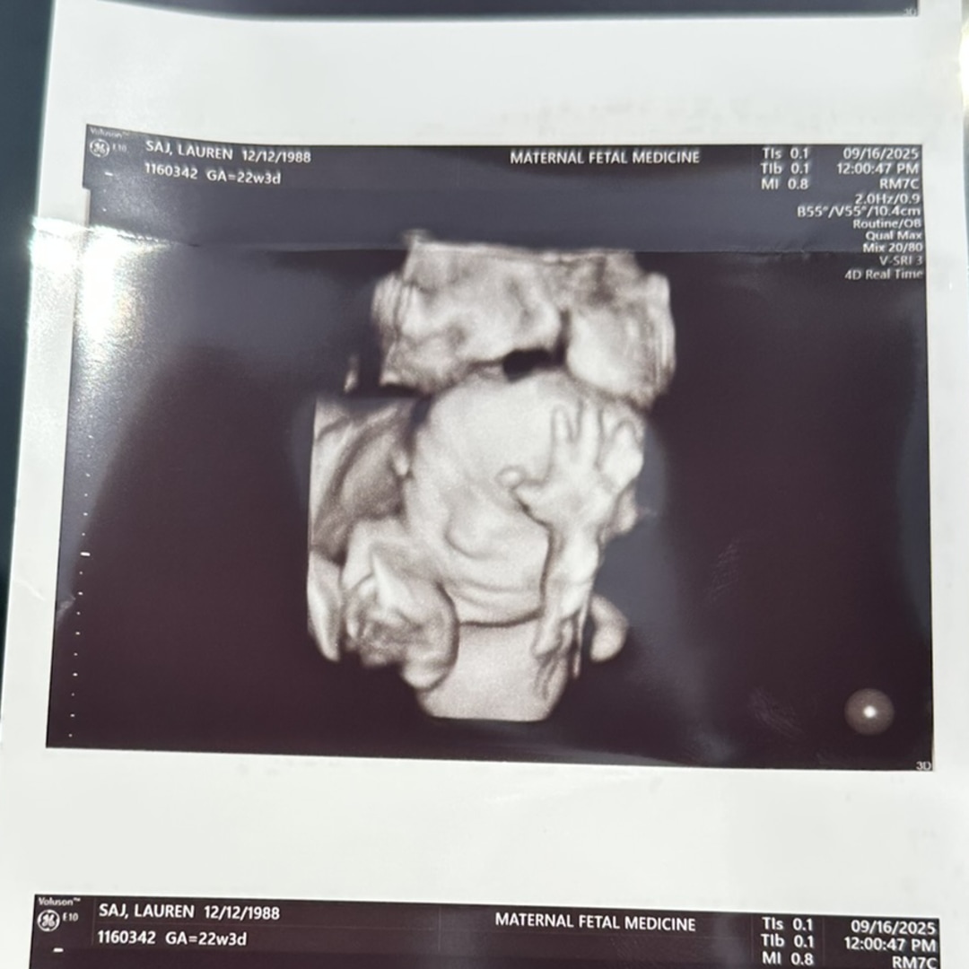 Photo shared by Lauren for their Babylist baby registry.