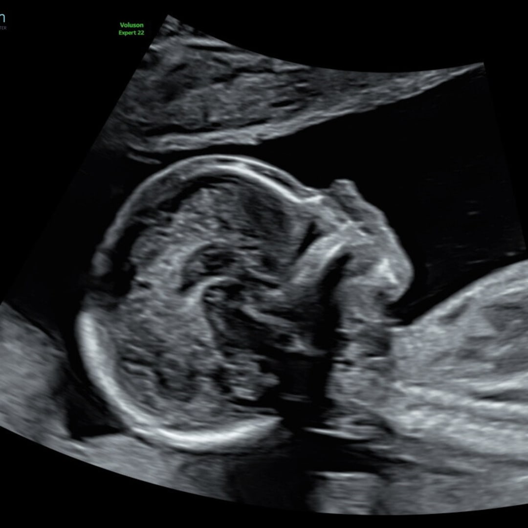 Photo shared by Sami for their Babylist baby registry.