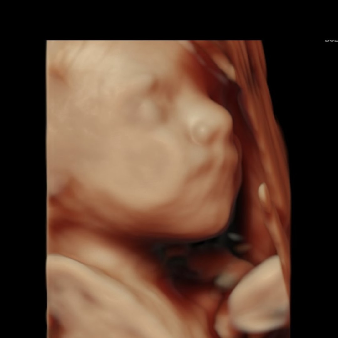 Photo shared by Madeline for their Babylist baby registry.