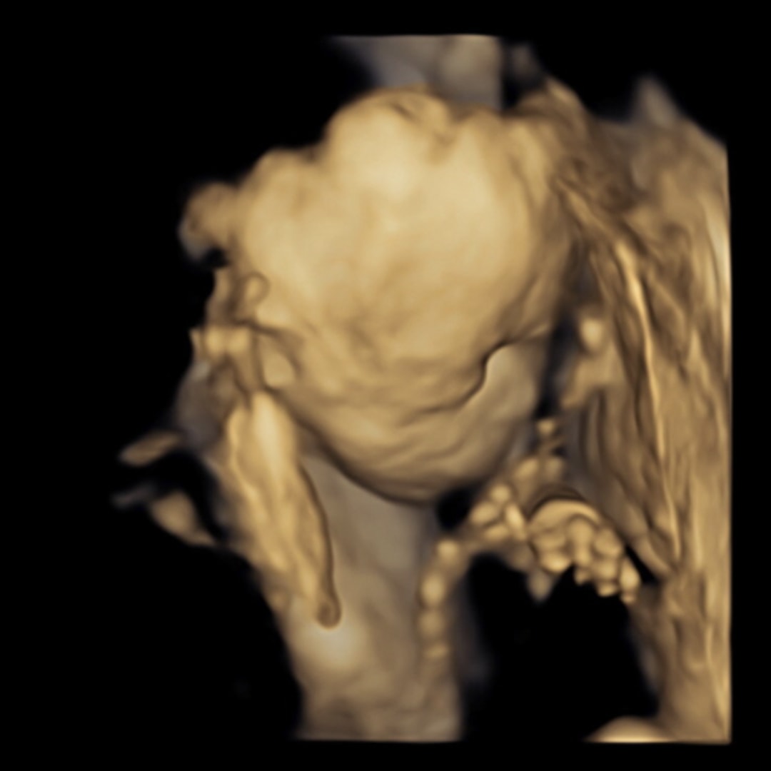 Photo shared by Cindy for their Babylist baby registry.