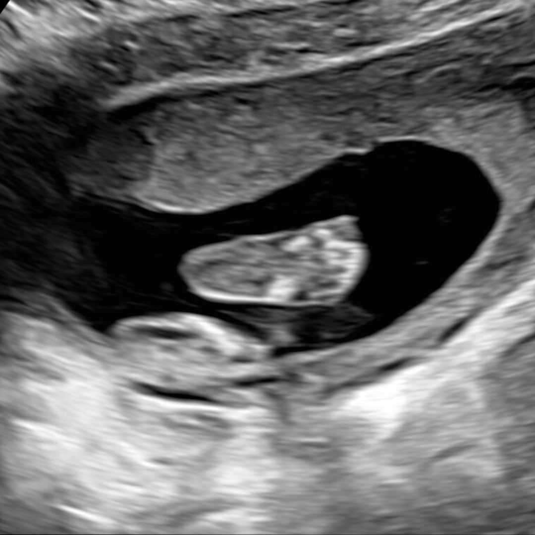 Photo shared by Josie for their Babylist baby registry.