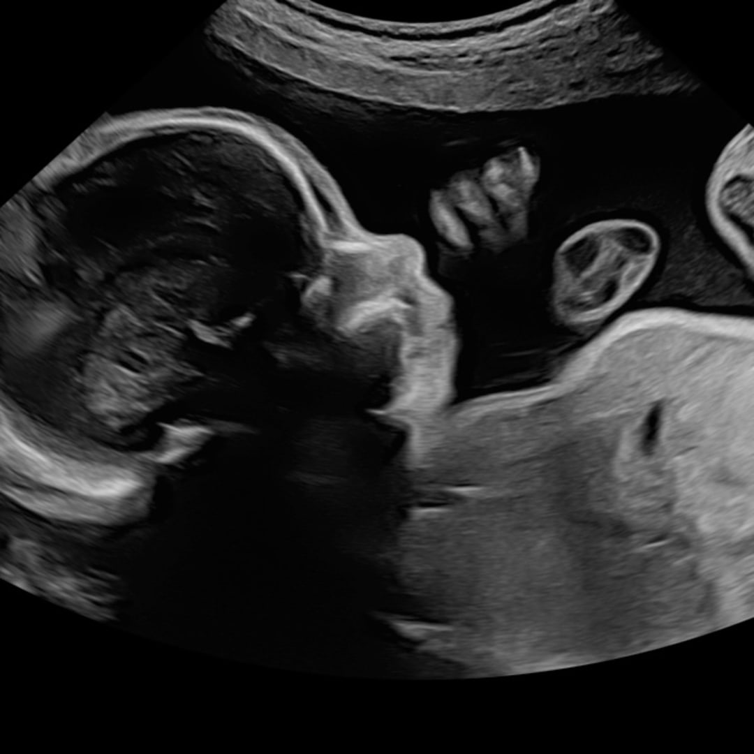 Photo shared by Shalyce for their Babylist baby registry.