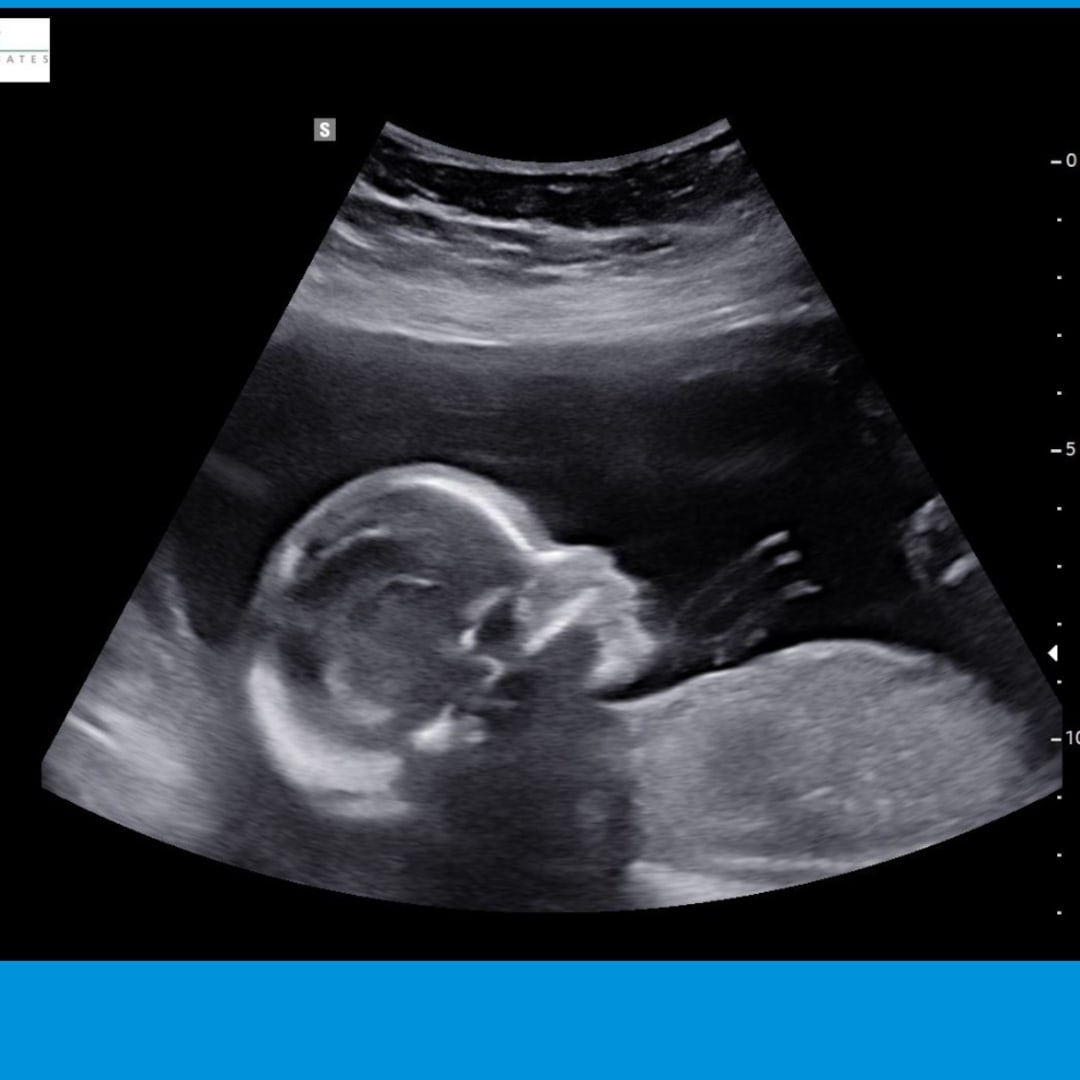 Photo shared by Emma for their Babylist baby registry.