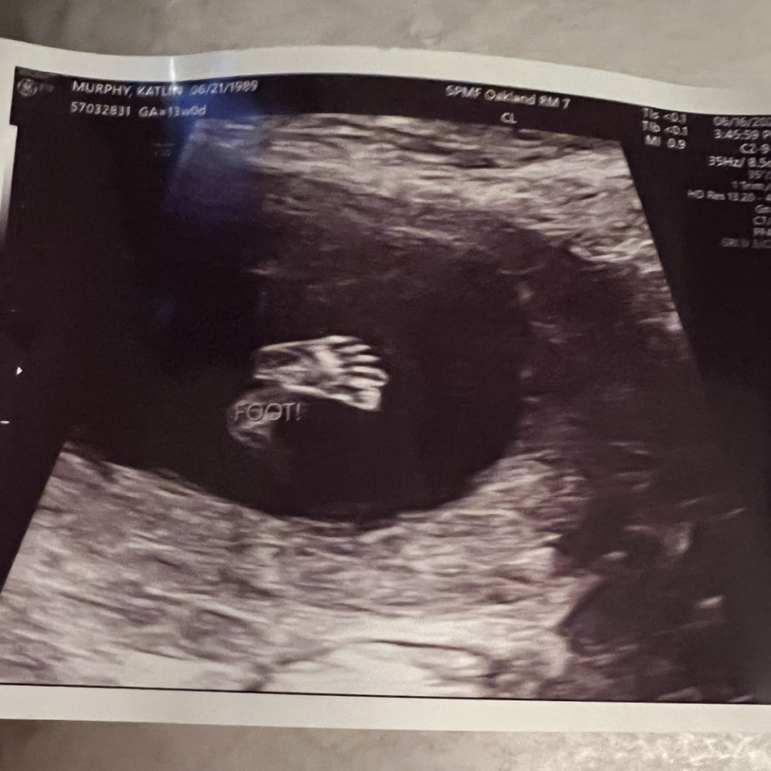 Photo shared by Katlin for their Babylist baby registry.