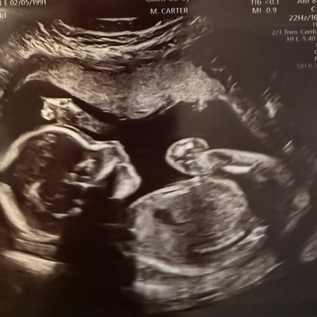 Photo shared by Meghan for their Babylist baby registry.