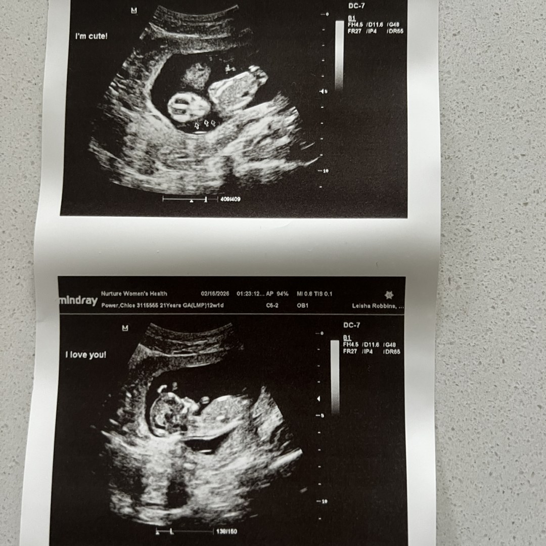 Photo shared by Chloe for their Babylist baby registry.