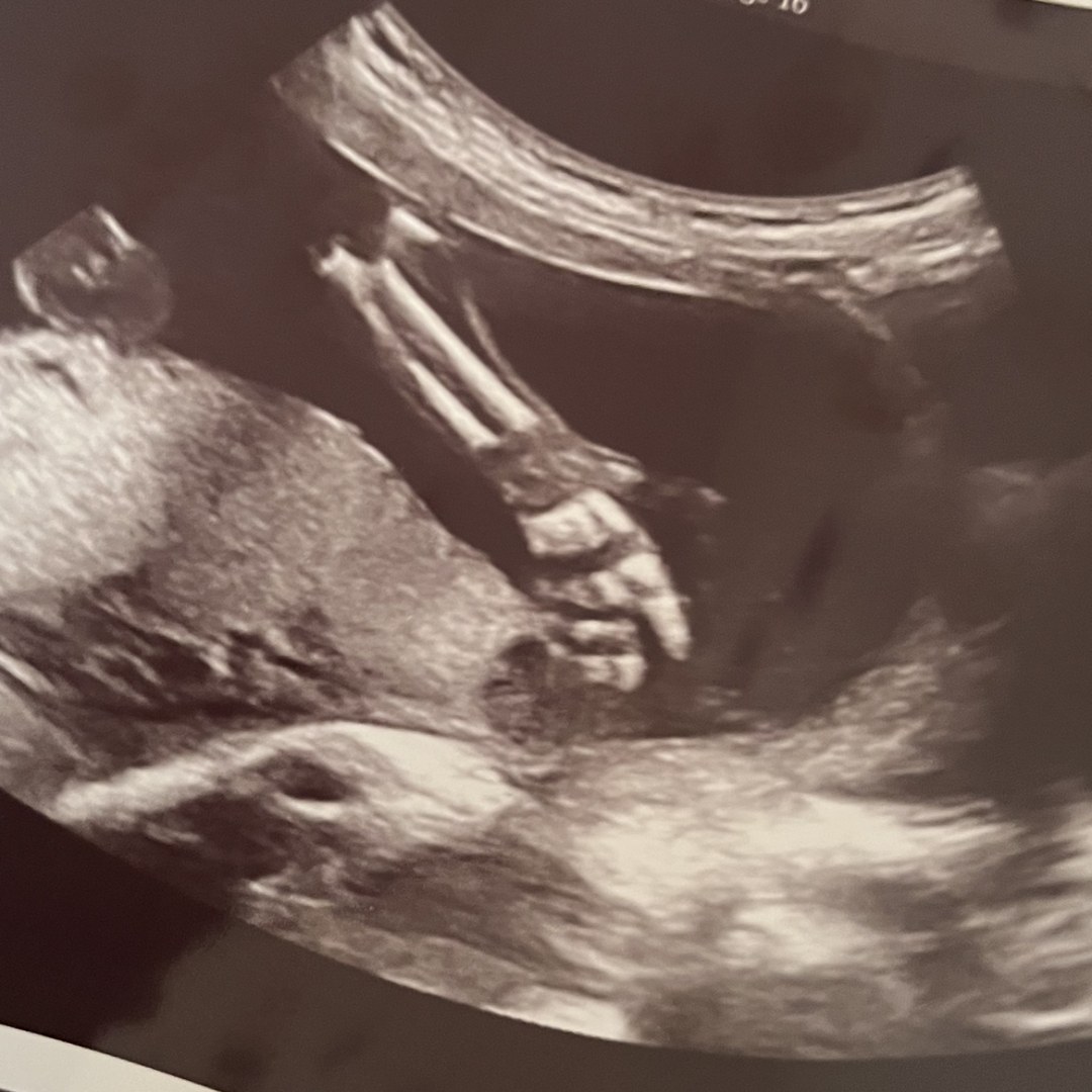 Photo shared by Jaylen for their Babylist baby registry.