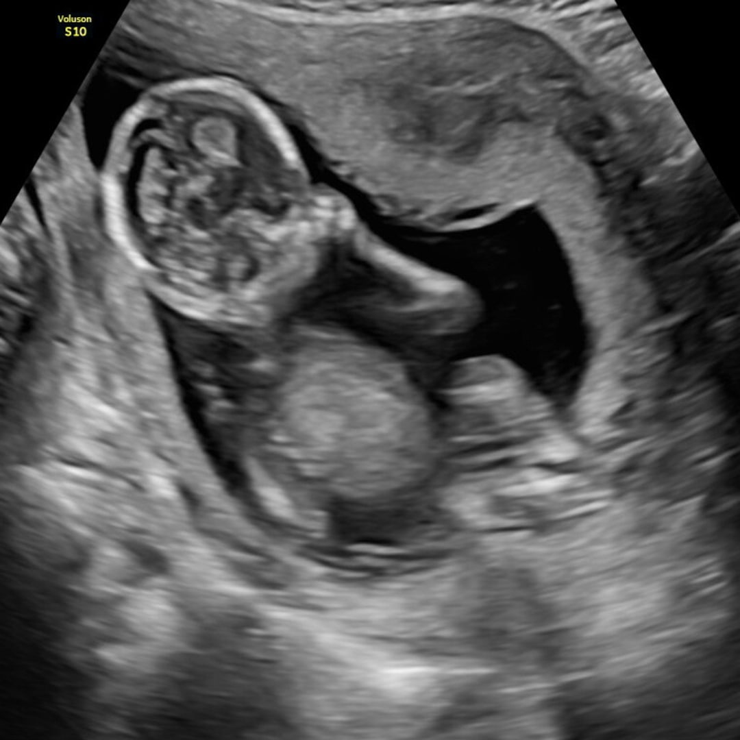 Photo shared by Amara for their Babylist baby registry.