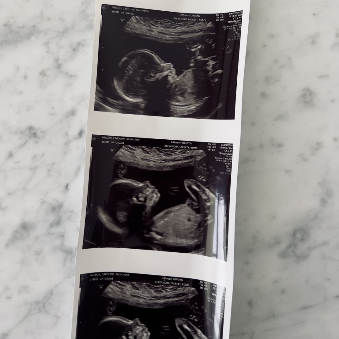 Photo shared by Caroline for their Babylist baby registry.