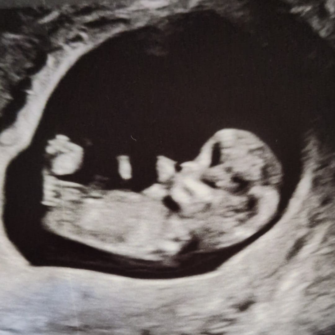 Photo shared by Kat for their Babylist baby registry.