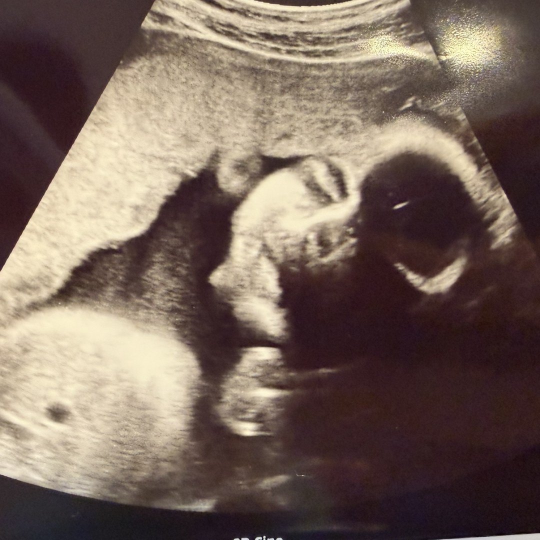 Photo shared by Allie for their Babylist baby registry.