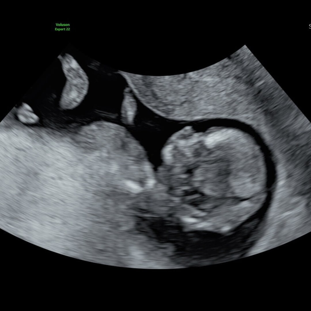 Photo shared by Kelly for their Babylist baby registry.