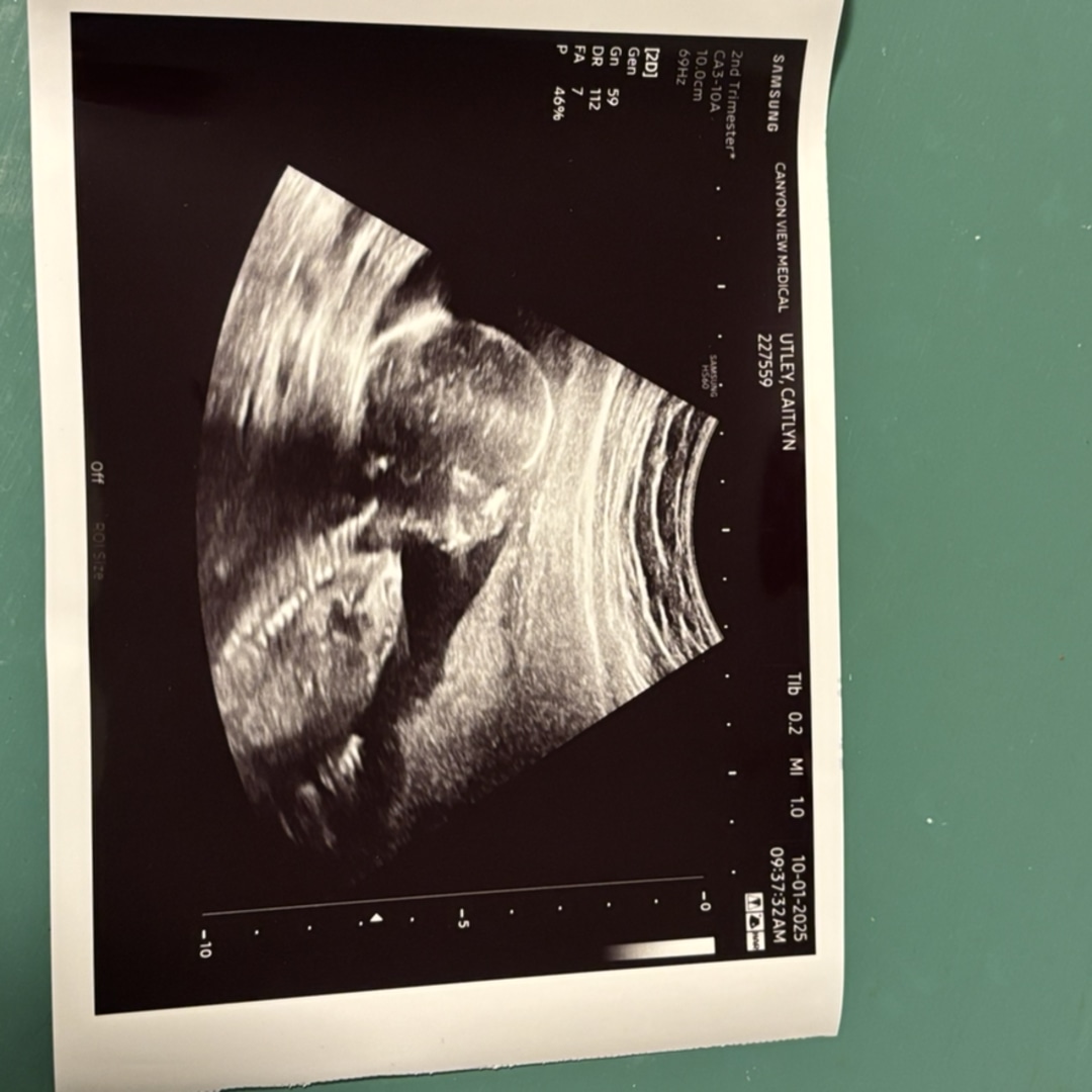 Photo shared by Caitie for their Babylist baby registry.