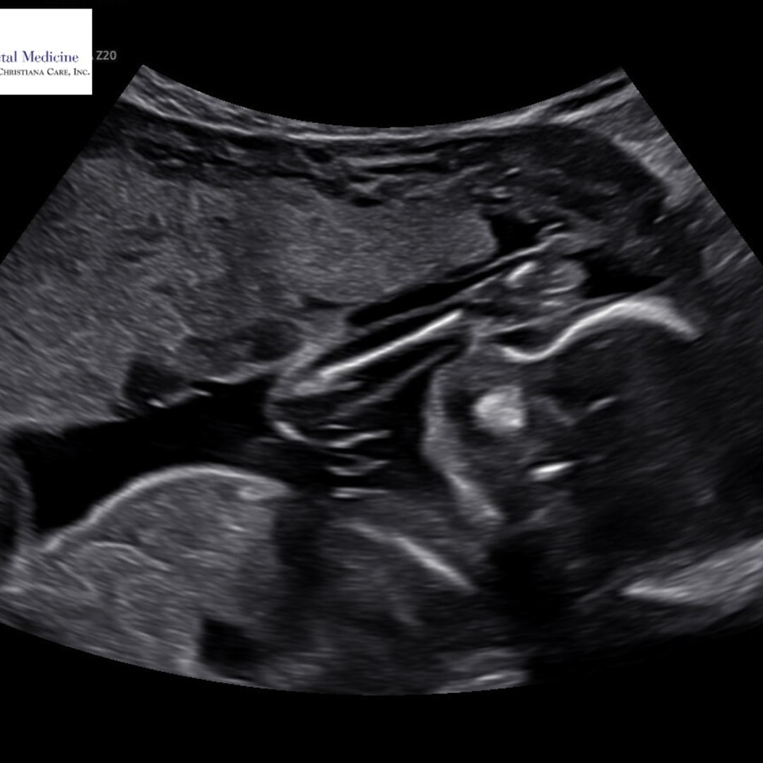 Photo shared by Leslie for their Babylist baby registry.
