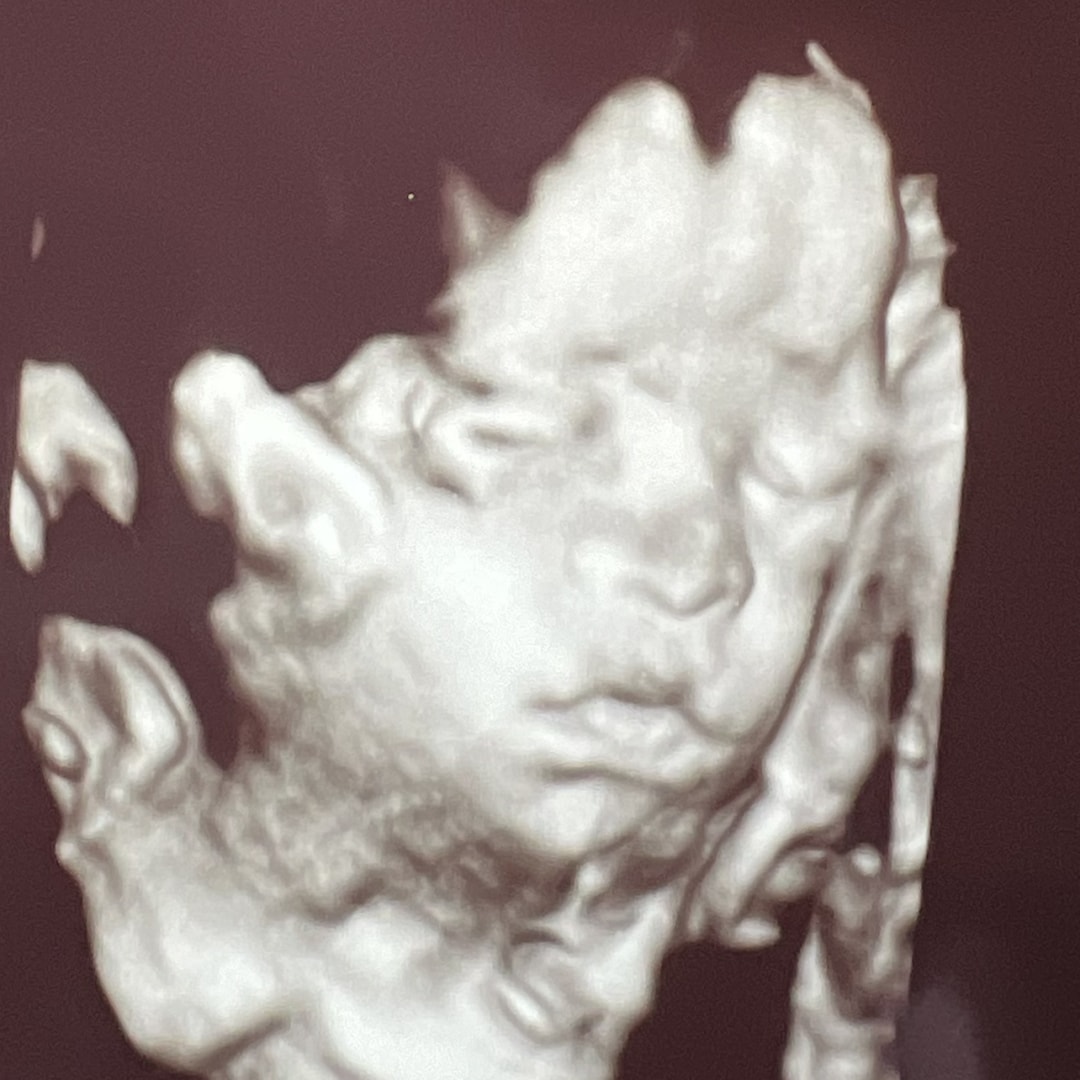 Photo shared by Kennedi for their Babylist baby registry.