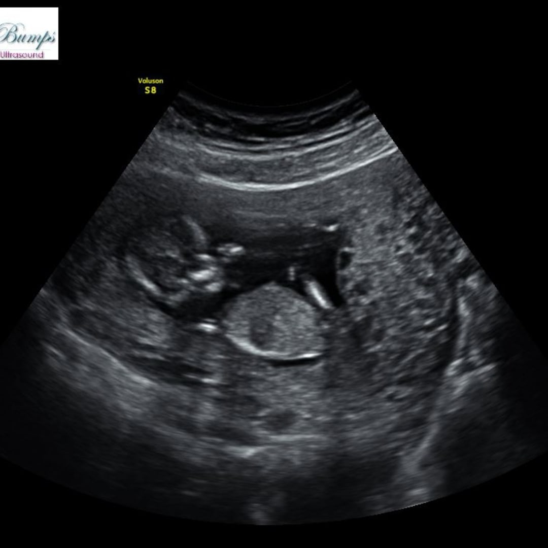 Photo shared by Aileen for their Babylist baby registry.