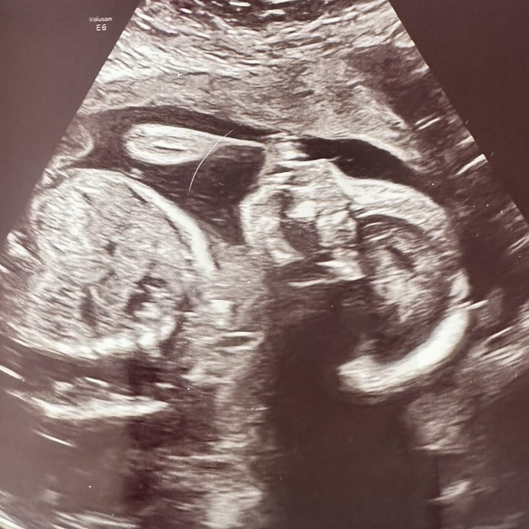 Photo shared by Tanya for their Babylist baby registry.