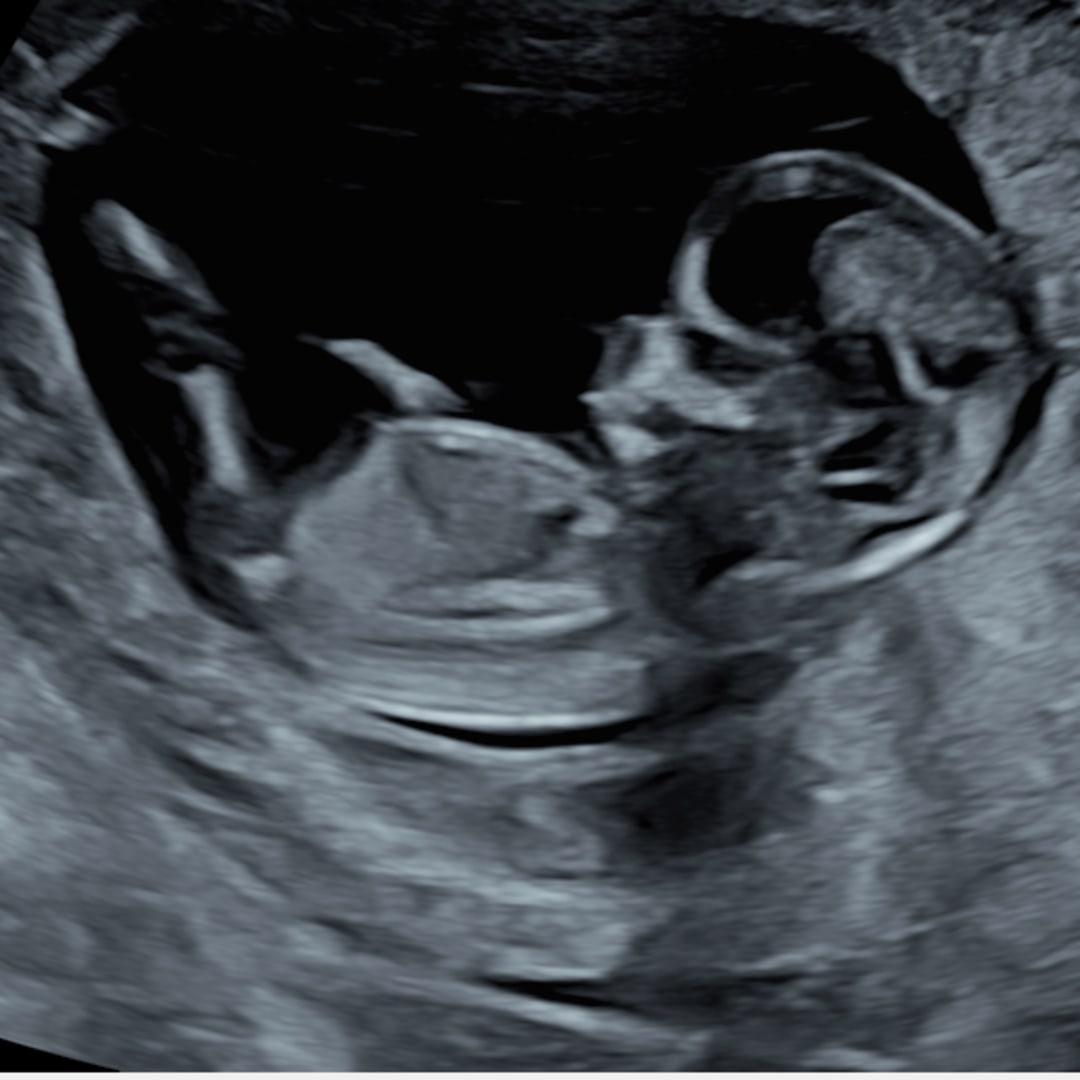 Photo shared by Olivia for their Babylist baby registry.