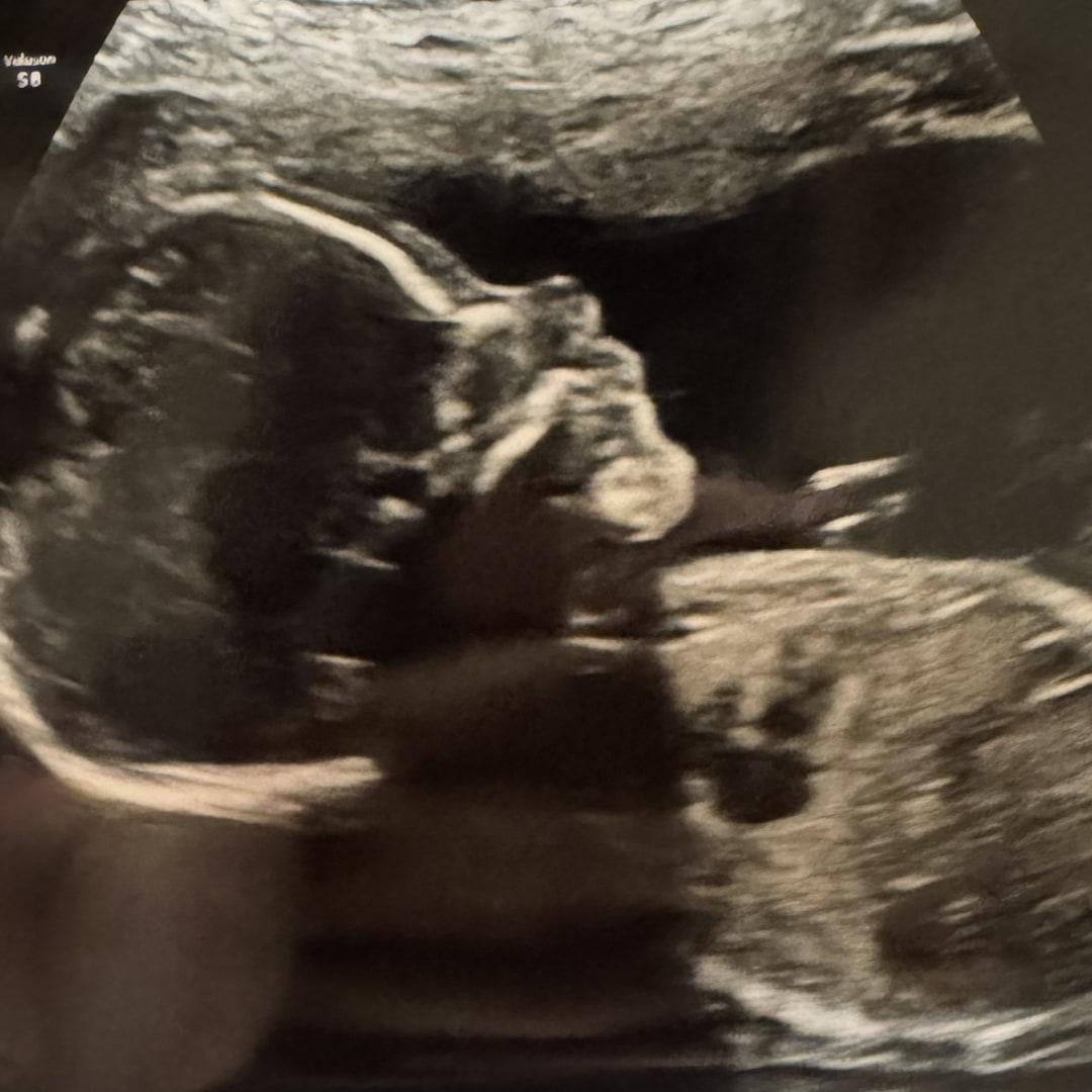 Photo shared by Lisa for their Babylist baby registry.