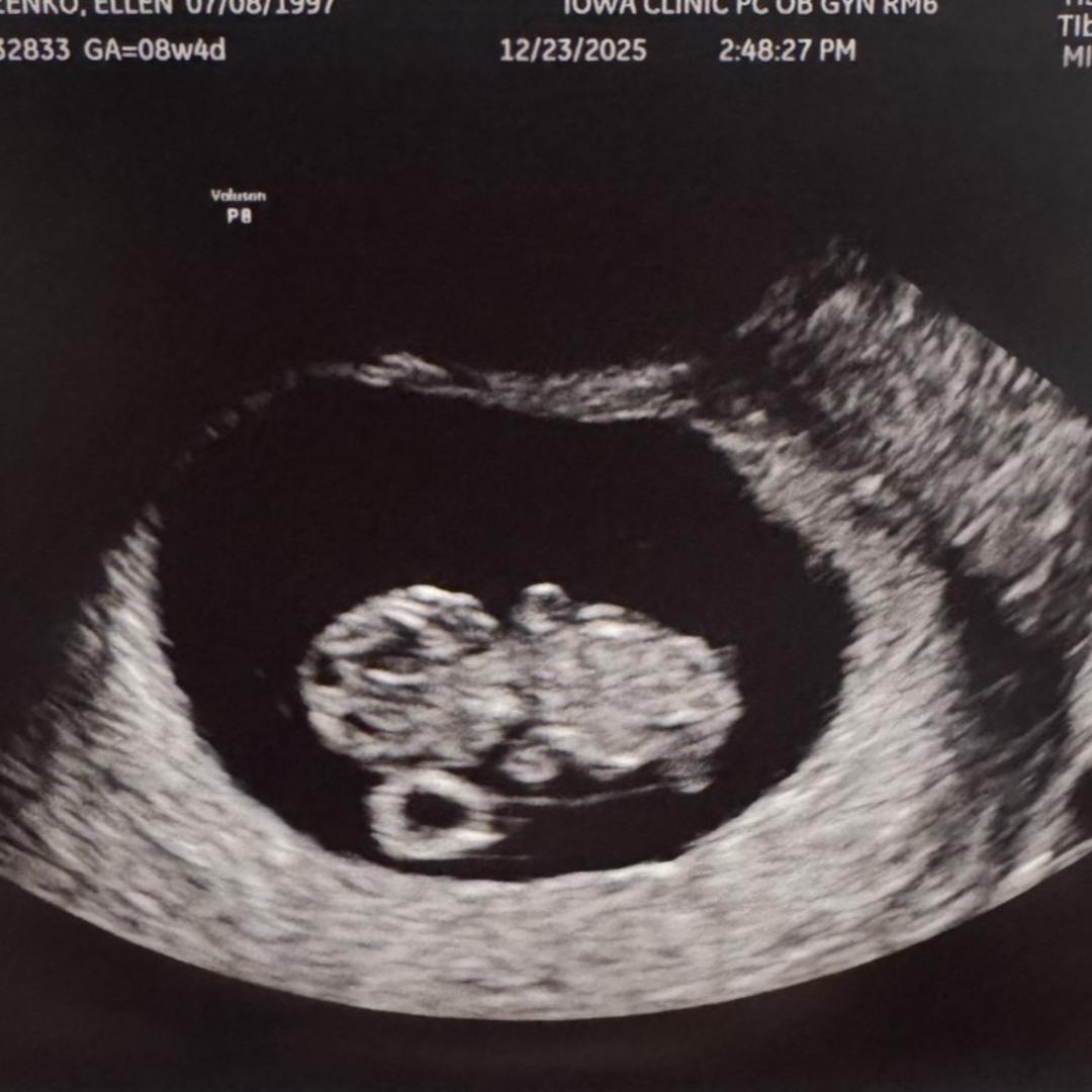 Photo shared by Ellie for their Babylist baby registry.