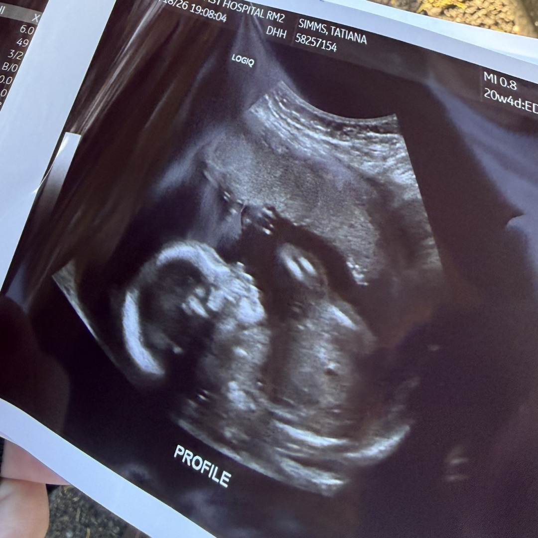 Photo shared by Tatiana for their Babylist baby registry.
