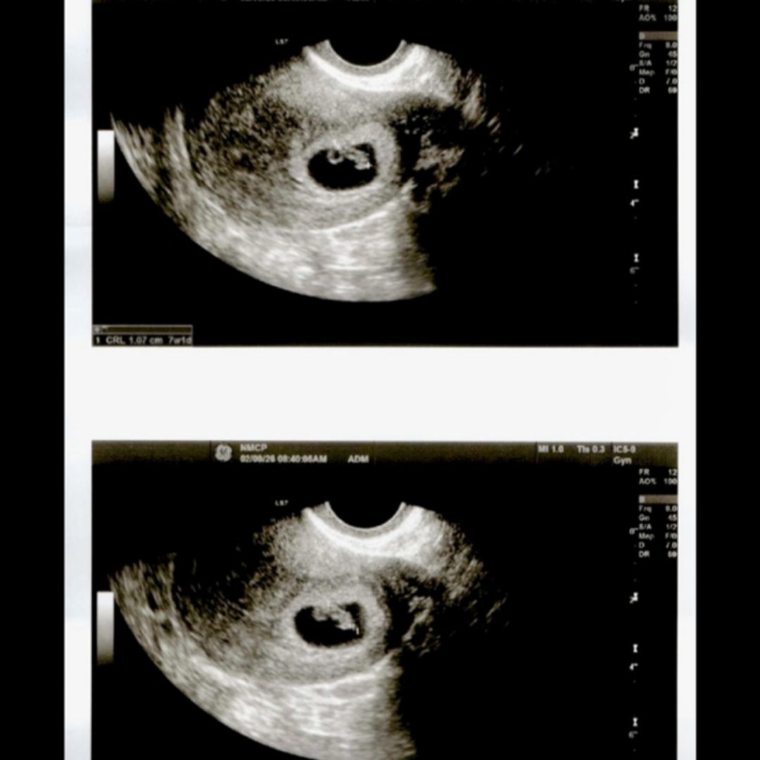 Photo shared by Imari for their Babylist baby registry.