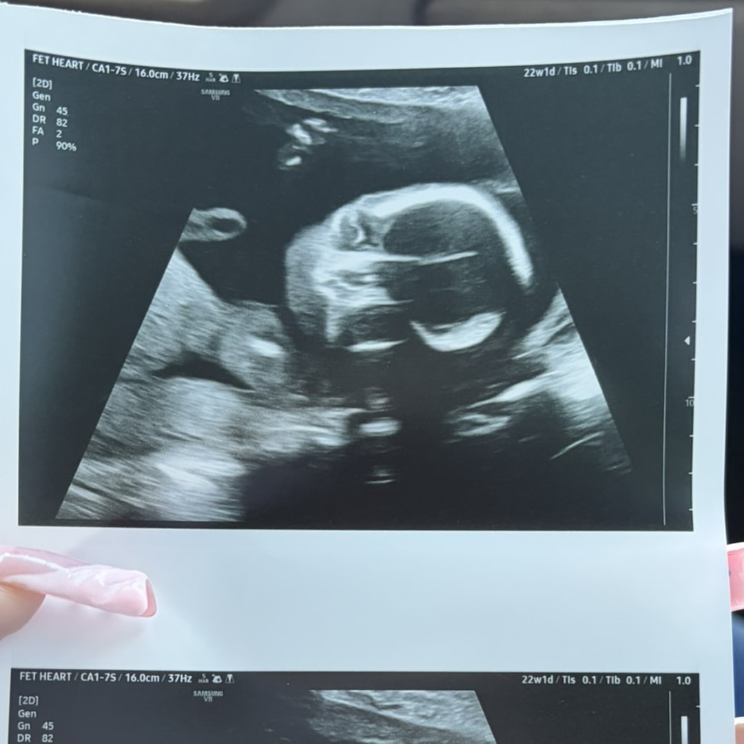 Photo shared by Karla for their Babylist baby registry.