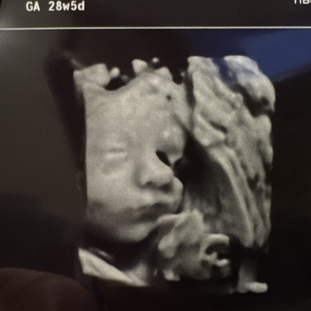 Photo shared by Hannah for their Babylist baby registry.