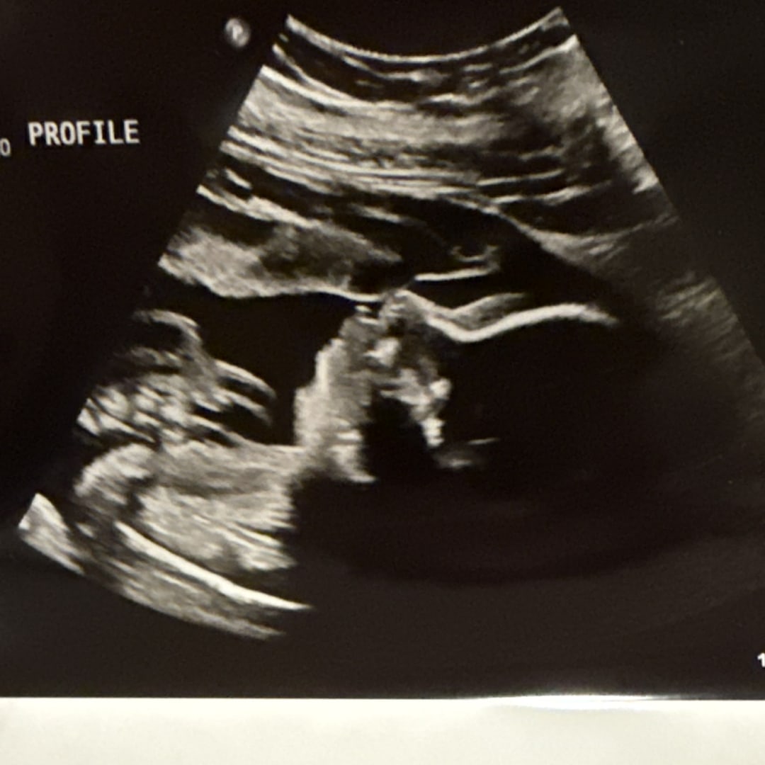 Photo shared by Gileen for their Babylist baby registry.