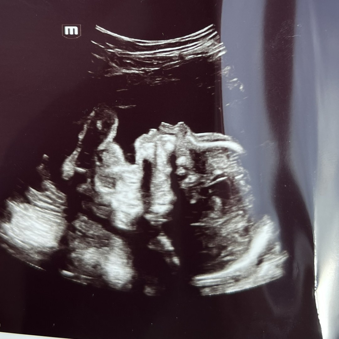 Photo shared by Caroline for their Babylist baby registry.