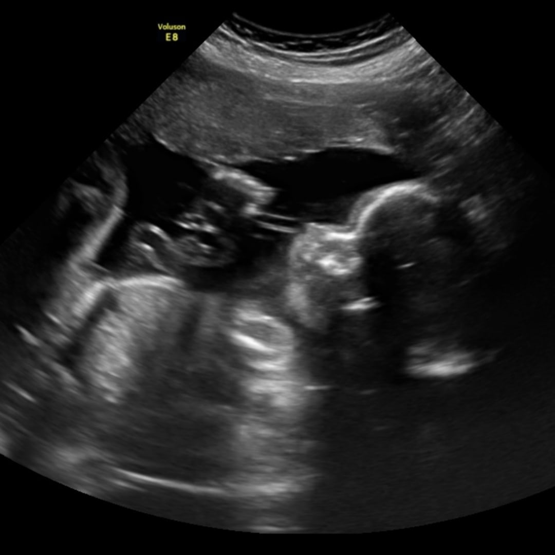 Photo shared by Bailey for their Babylist baby registry.