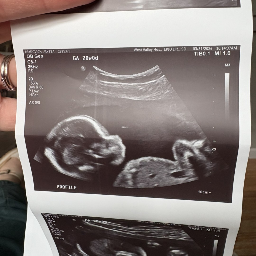 Photo shared by Alyssa for their Babylist baby registry.
