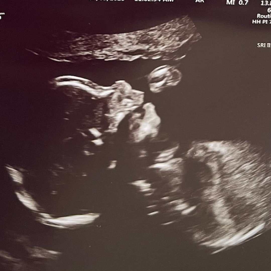 Photo shared by Moriah for their Babylist baby registry.