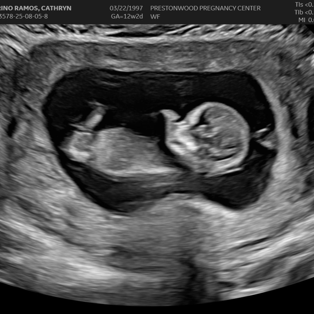 Photo shared by CJ for their Babylist baby registry.