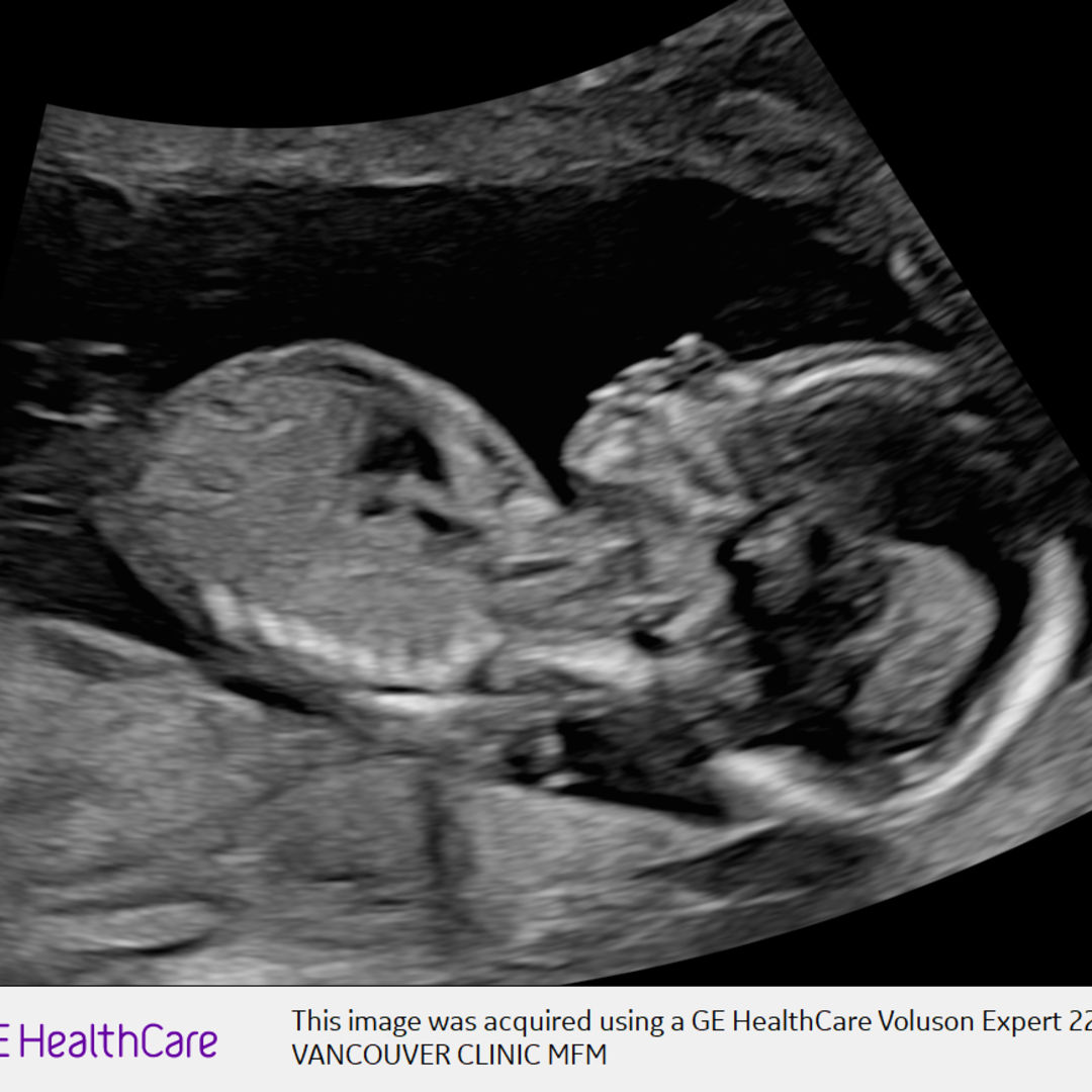 Photo shared by Hannahjoy for their Babylist baby registry.
