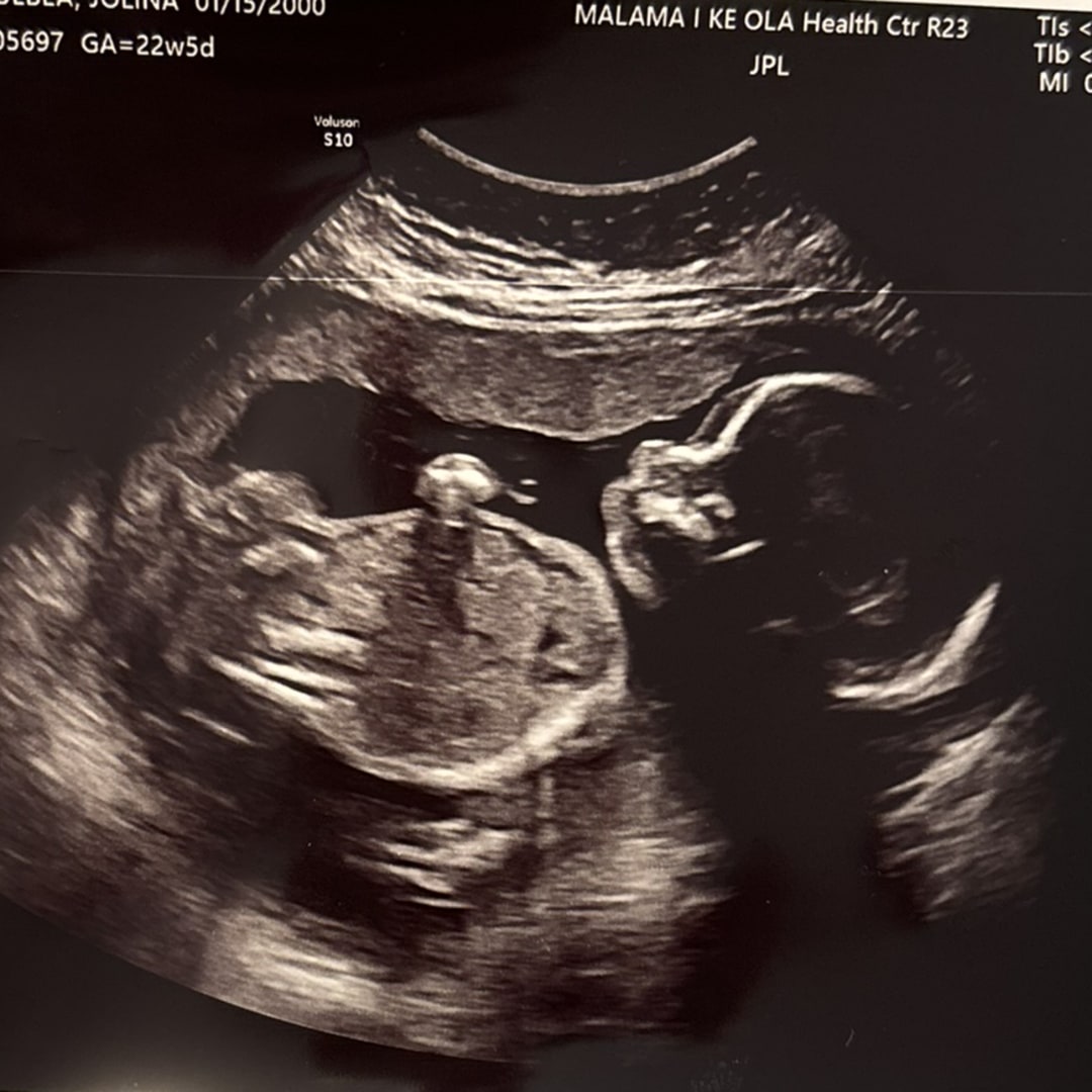 Photo shared by Jolina for their Babylist baby registry.